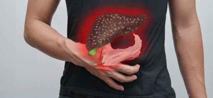 Pengertian Singkat Dari Penyakit Hepatitis A